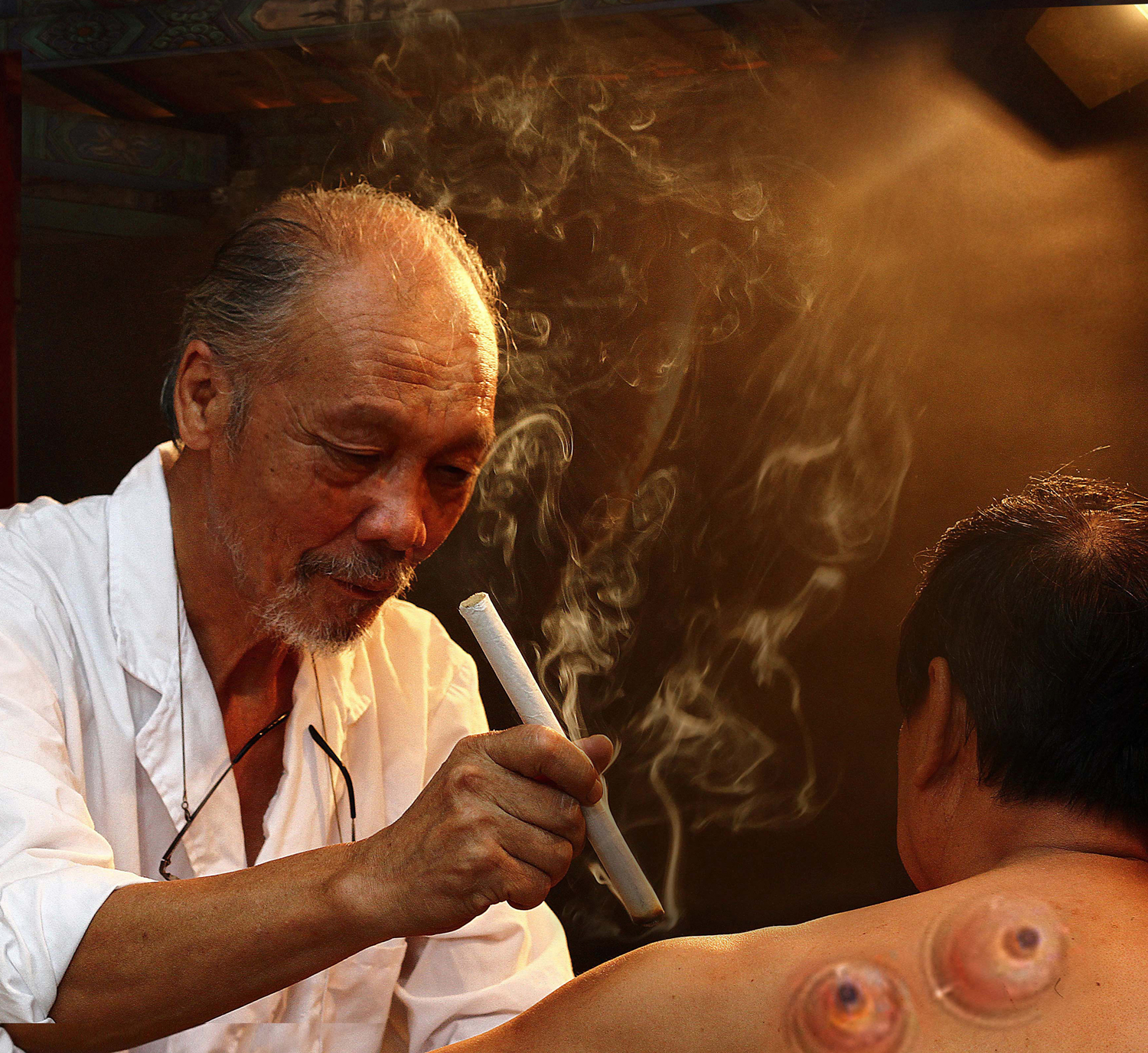 作品名称中医疗法-艾灸姓名 佟伟元电话13190071376拍摄地点罗庄区中医院.jpg